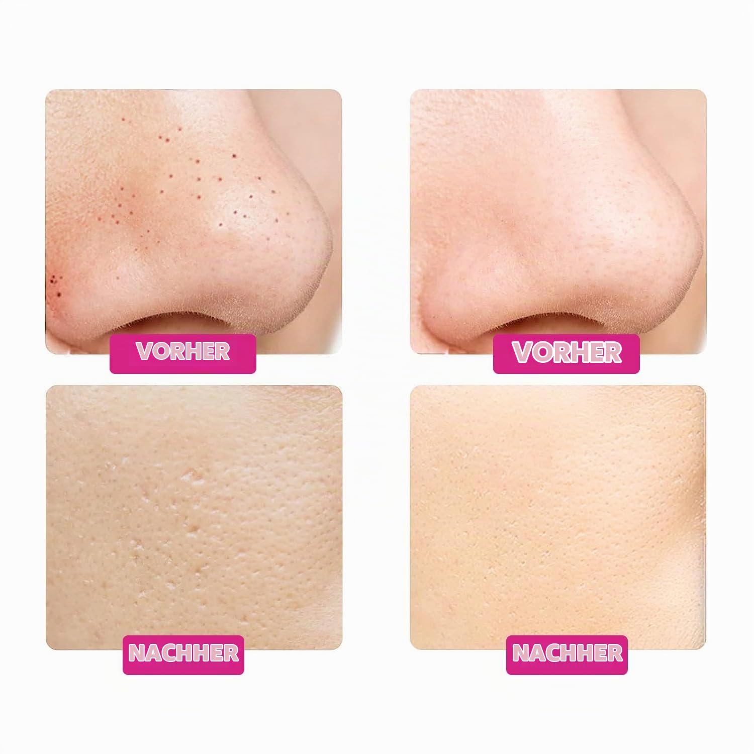 Gess Mamba Skin Scrubber Porenreiniger Schwarz-Pink Ultraschall