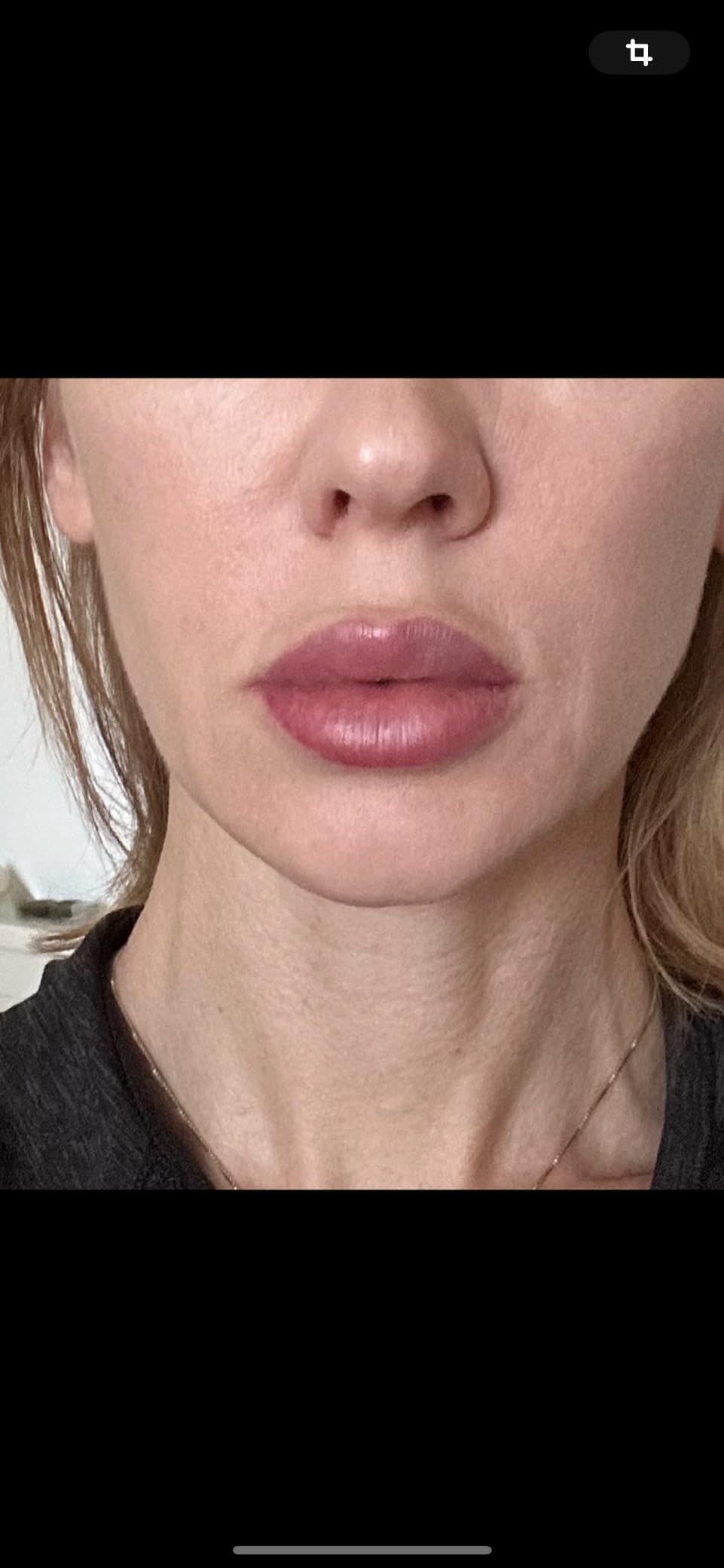 Gess Sfera Mikrostrom Gesichtsgerät Schwarz Anti-Aging