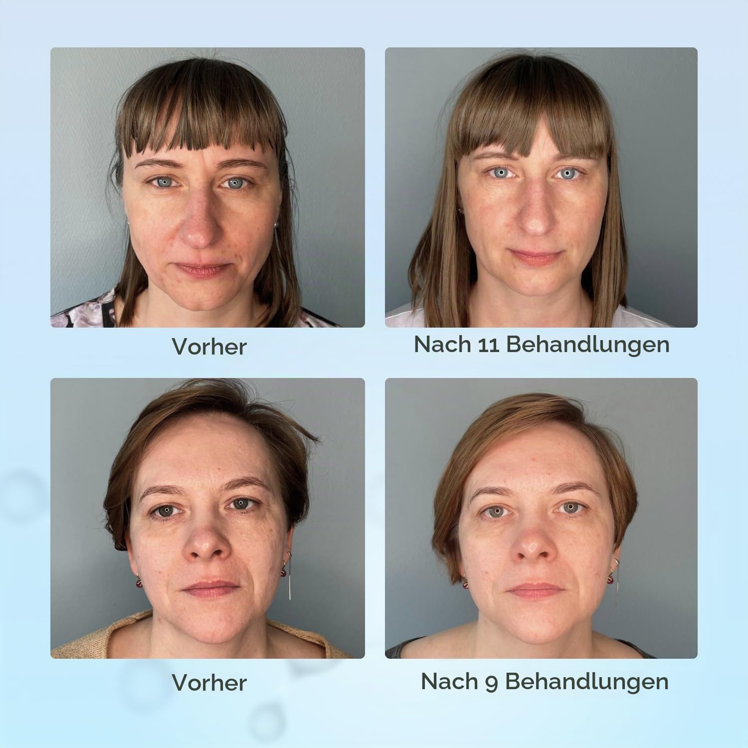 Gess FaceActive BMS Gesichtsmassagegerät Anti-Aging 3 Aufsätze