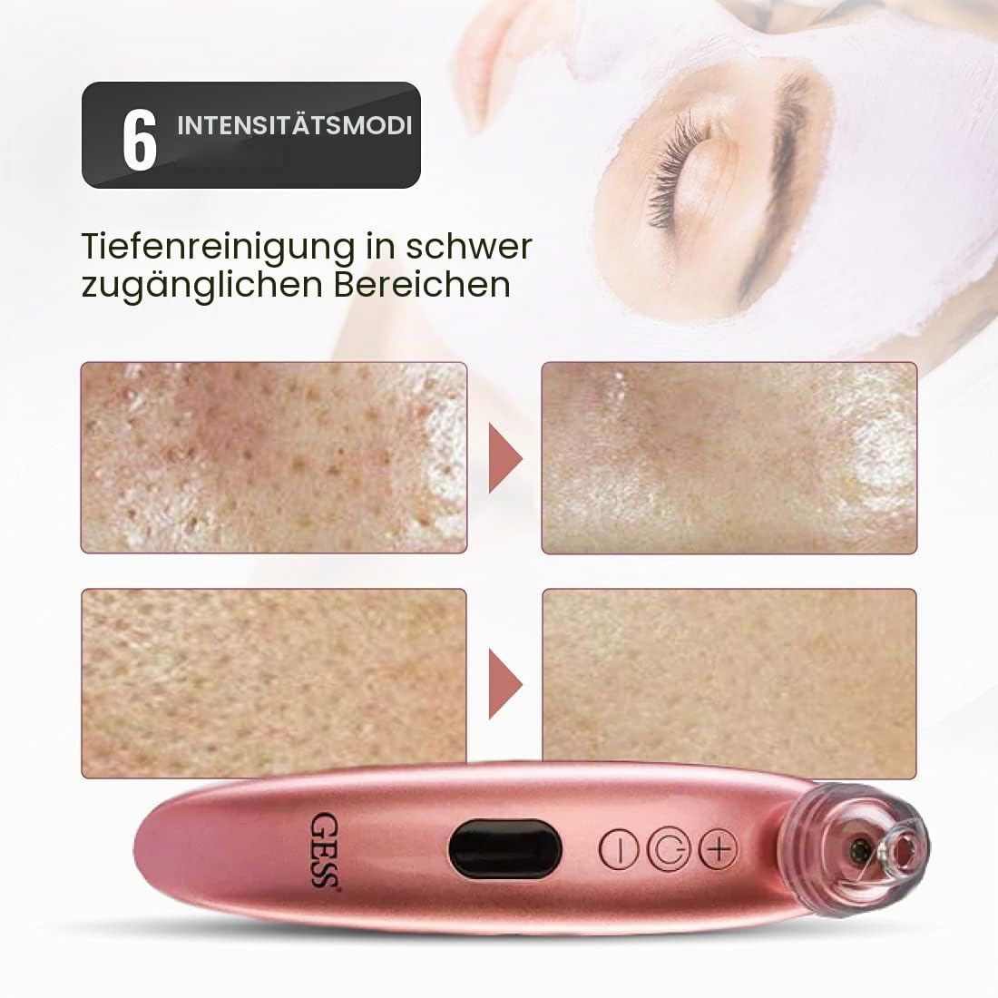 GESS Sleek Mitesserentferner Porensauger Kamera 4 Aufsätze USB