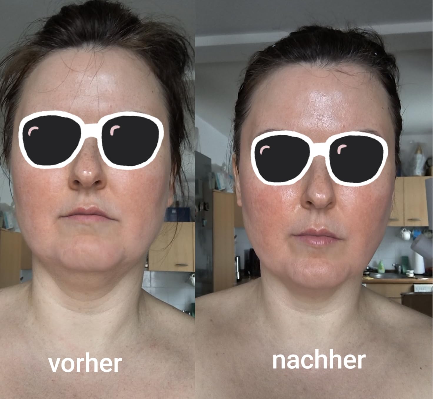 Gess Sfera Mikrostrom Gesichtsgerät Schwarz Anti-Aging